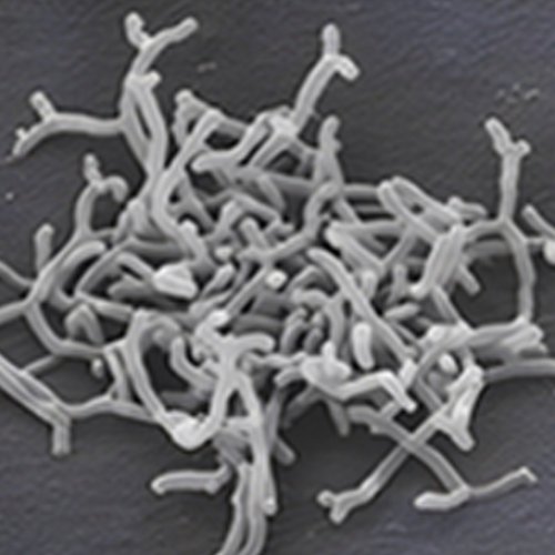 Bifidobacterium longum subsp. longum 